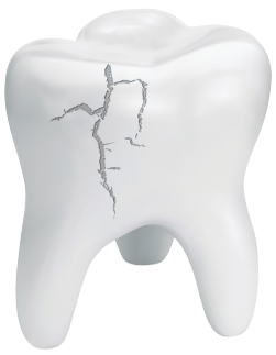 Emergency dental exam for a cracked tooth in Naperville